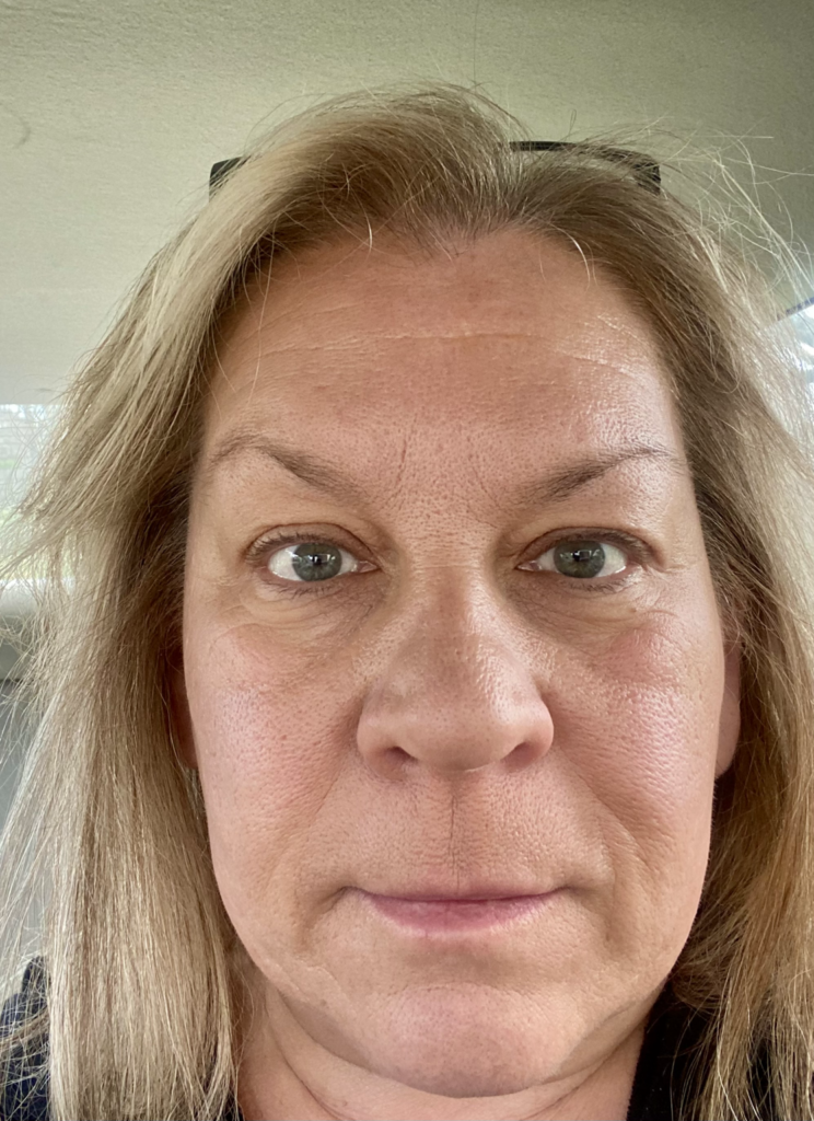 Lisa Cocchi skincare journey progress, April 2024