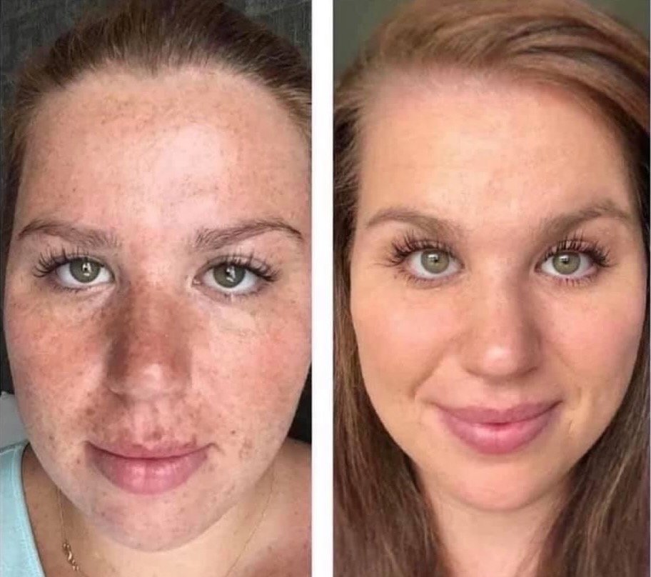 Before and after Age IQ skincare results showing visible improvement in skin tone, texture, and overall skin appearance