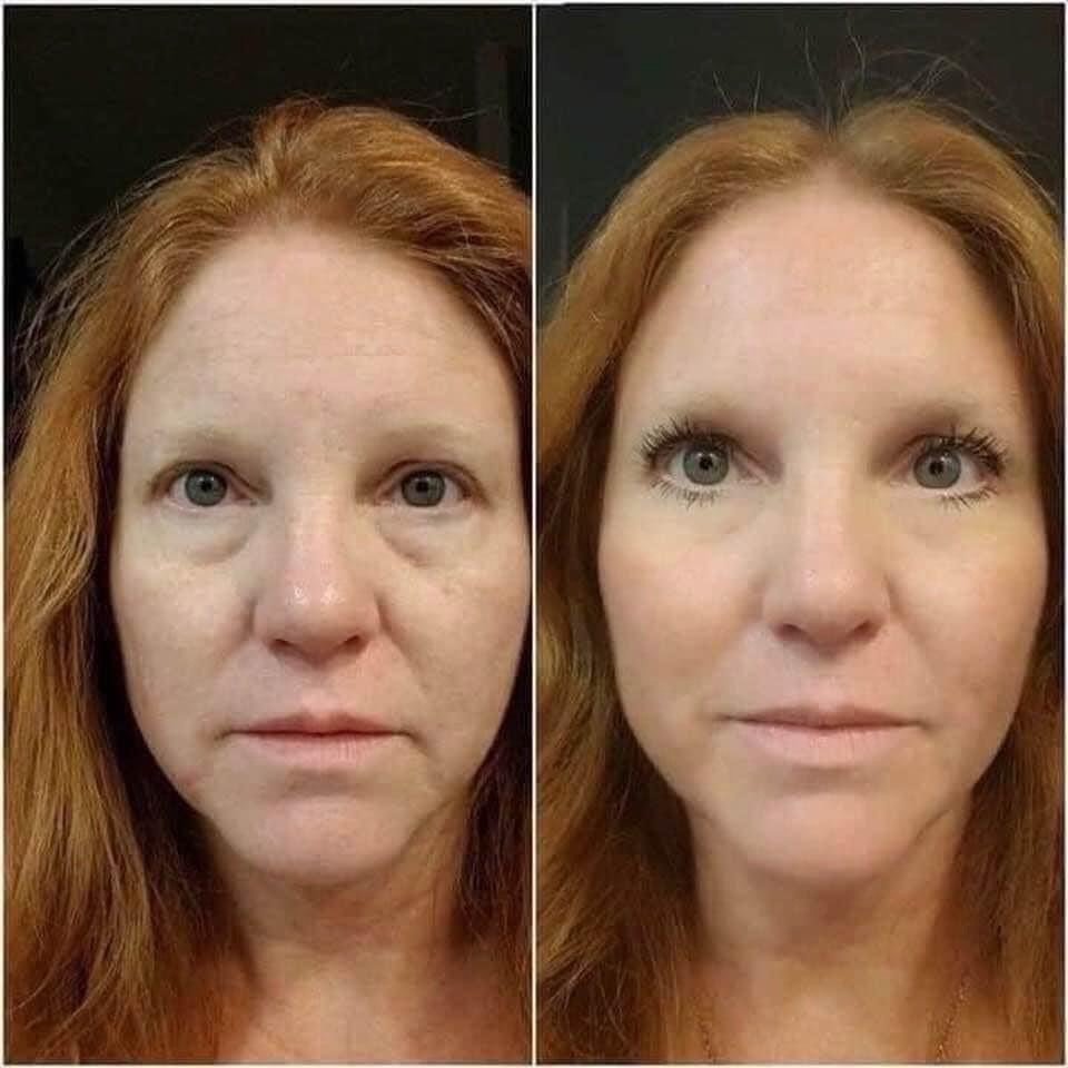 Before and after Age IQ skincare results showing visible improvement in skin texture, tone, and overall skin appearance