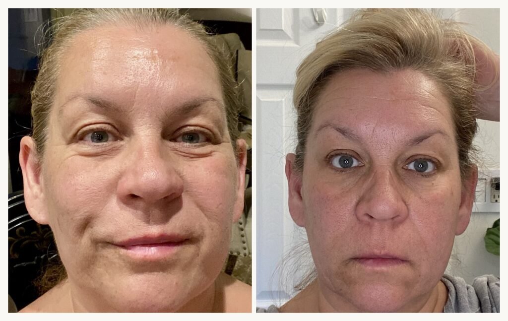 Before and after mature skin results showing smoother, firmer-looking skin